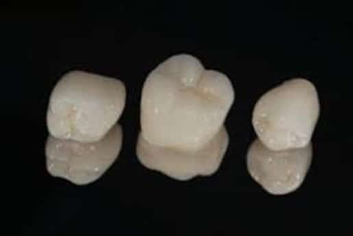 Same Day Crowns with CEREC